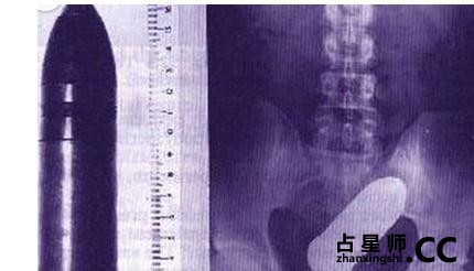 情侣玩过火 说说女子下体那些事