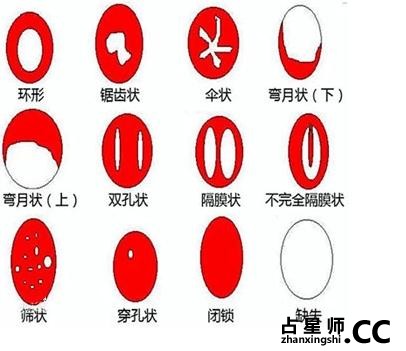 生理知识——处女膜的5次成长