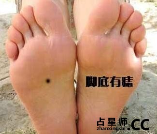 男女身上9大开运吉痣